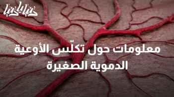 تكلّس الأوعية الدموية الصغيرة: الخطر الذي يخفيه تراكم الكالسيوم في الأنسجة