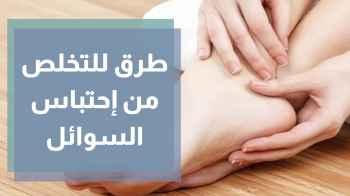 طرق التخلص من احتباس السوائل